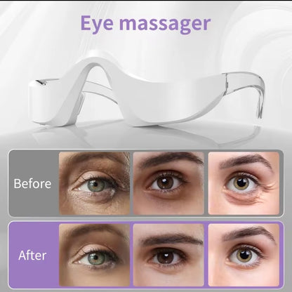 EyeRevive Therapy